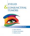 Eyelid & Conjunctival Tumors